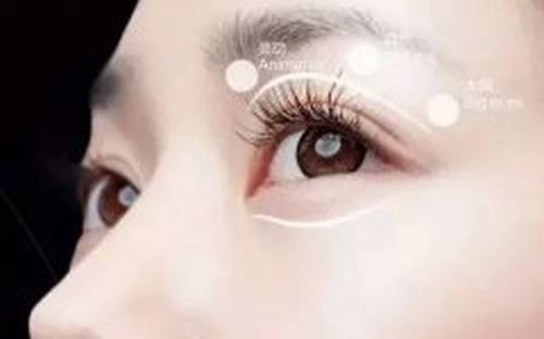双眼皮手术：几百的和的区别究竟在哪